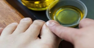 Essential oils to fight the fungus